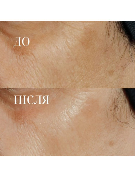 Perricone MD High Potency Triple Retinol Renewal Serum Омолоджуюча сироватка з ретинолом