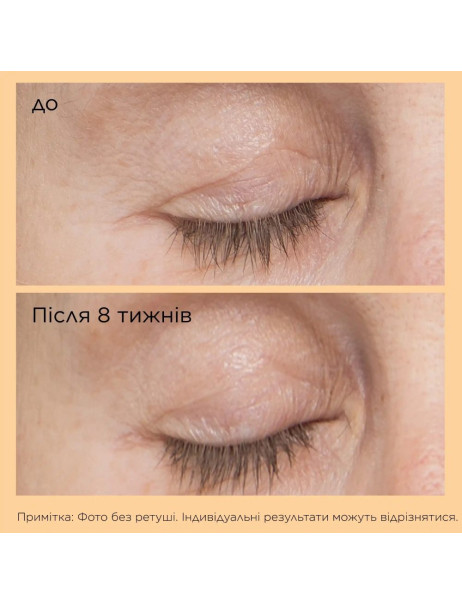 Сироватка для верхньої та нижньої повіки Acyl-Glutathione від Perricone MD
