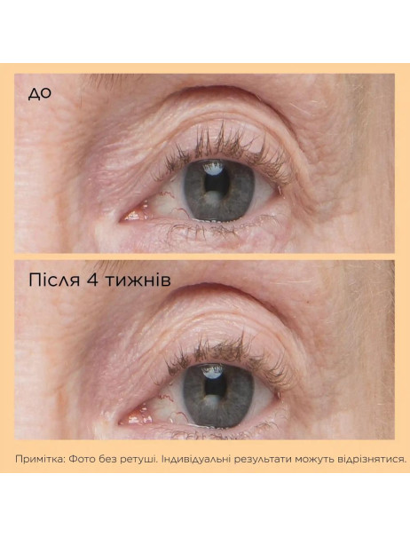 Омолоджуюча сироватка для повік Perricone MD Essential FX