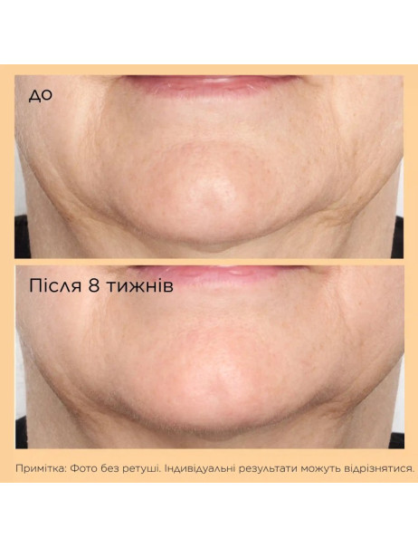 Perricone MD сироватка Acyl-Glutathione