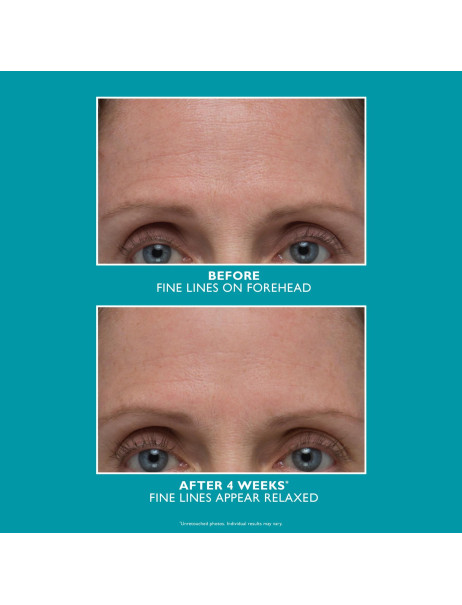 Peter Thomas Roth Peptide Skinjection Amplified Wrinkle-Fix Serum Інтенсивна сироватка для боротьби зі зморшками