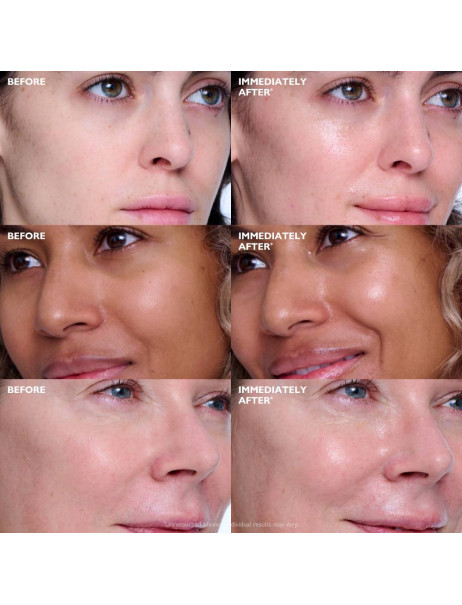 Peter Thomas Roth Collagen Skinjection Plumping & Firming Serum Сыворотка для восстановления и разглаживания кожи