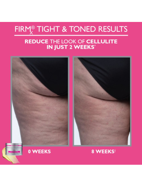 Peter Thomas Roth FIRMx Tight & Toned Cellulite Treatment Антицелюлітний крем для тіла