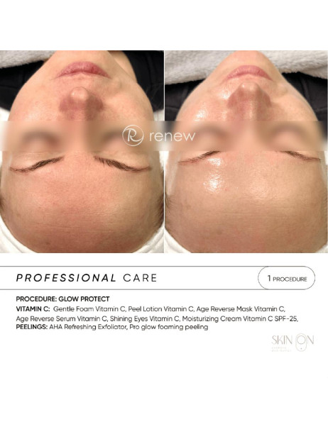 Renew Pro Glow Foaming Peeling Пінний пілінг