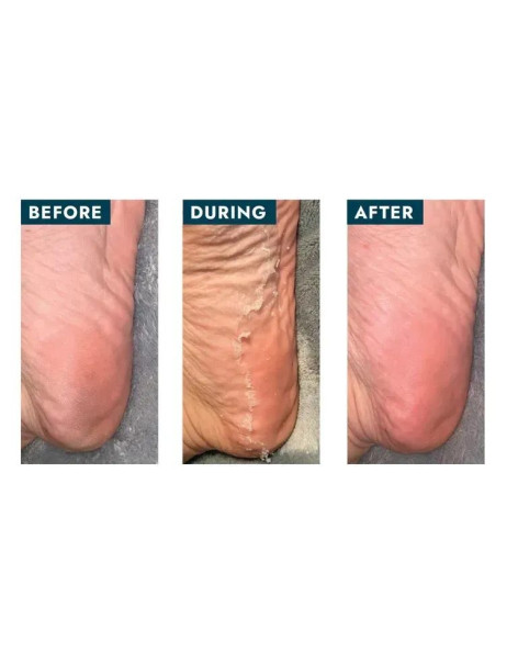 Voesh Peeling Socks with Plant-based AHA + 17 Botanical Extracts Носки-пилинги c AHA +17 растительных экстрактов