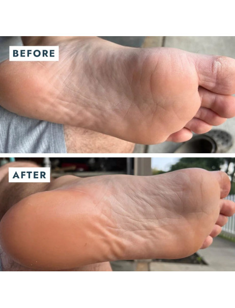 Voesh Solemate Heel Repair Balm Восстанавливающий бальзам для пяток